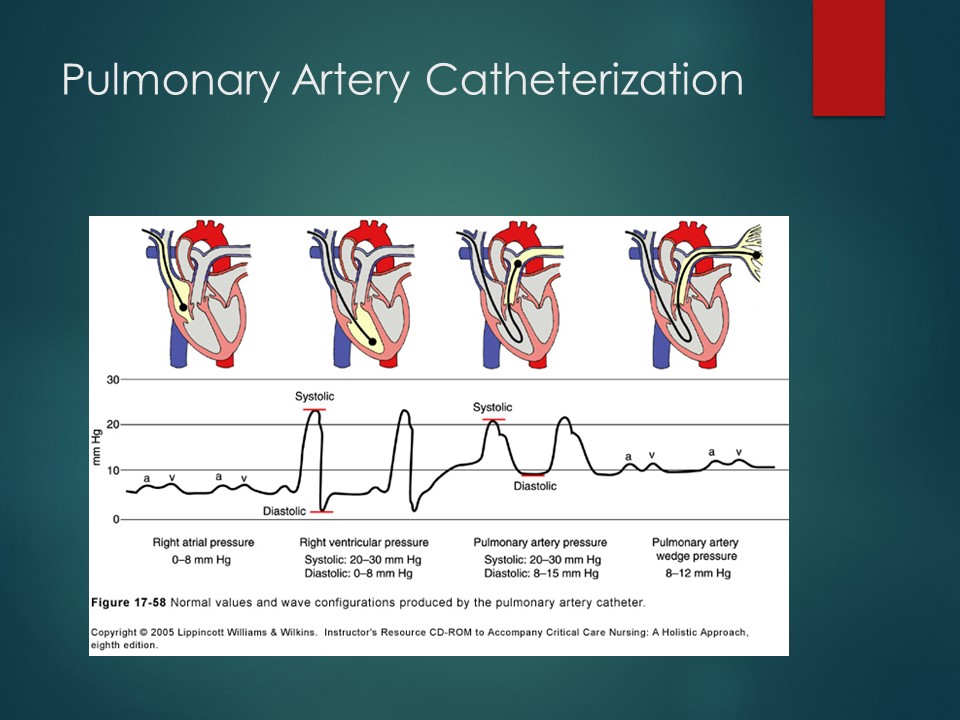 CVT Mohd Farid Introduction To Right Heart Catheterization