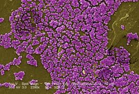 streptococcus-pneumonia-microscopic-image