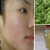 Don't Waste Your Money on Laser, Wash Your Face With This Before Going To Bed To Eliminate Wrinkles and Acne