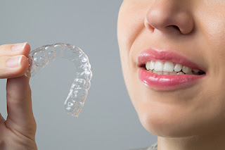  INVISALIGN FOR ADULTS