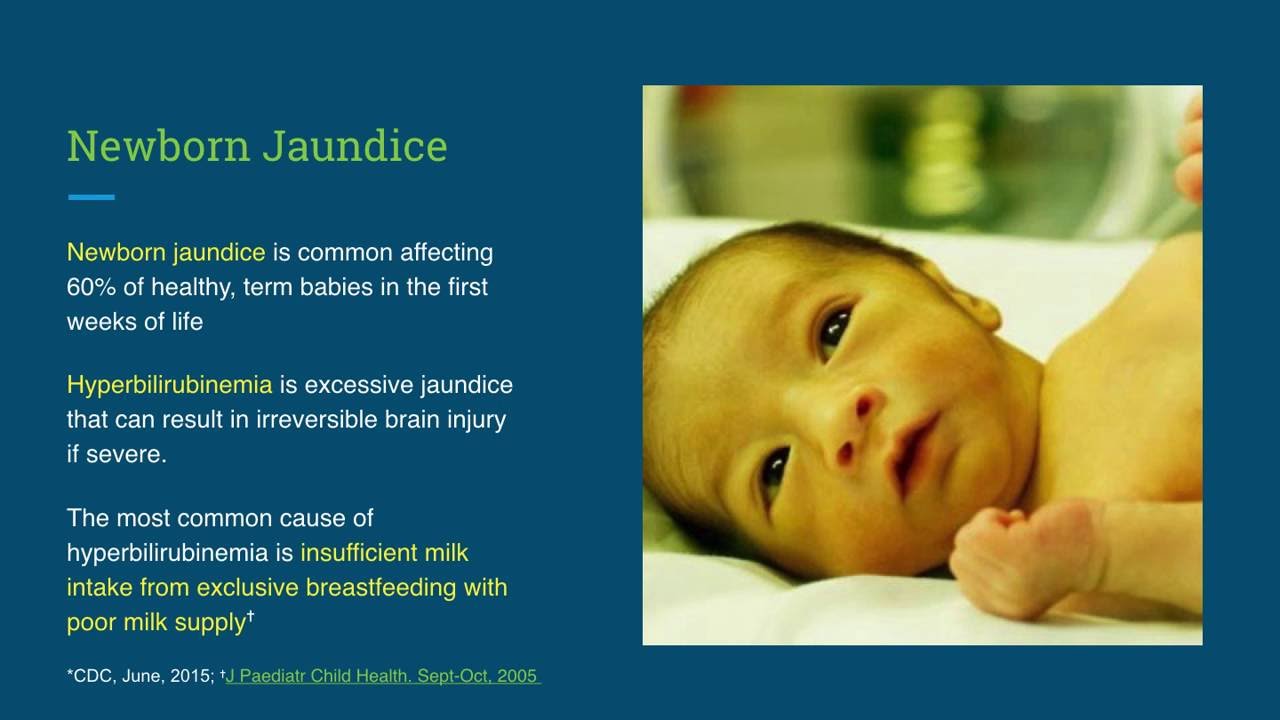 Why do newborn babies get jaundice? KNUDGE FACTORY