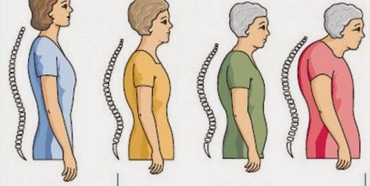 Cara Alami untuk Mencegah Osteoporosis Cara Alami untuk Mencegah Osteoporosis