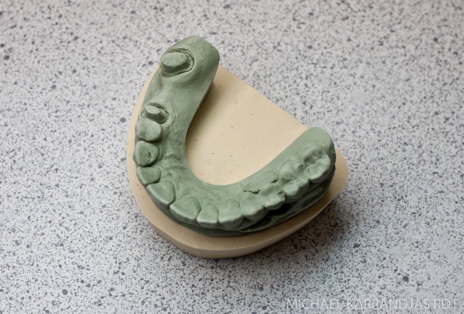 Dental Lab Model Fabrication | Making Noise And Drinking Beer