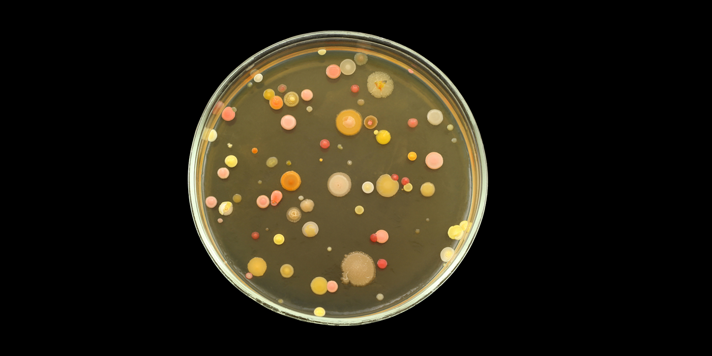 Желтые бактерии. Колонии бактерий в чашке Петри. E coli на чашке Петри. Кишечная палочка в чашке Петри. Чашка Петри с бактериями.