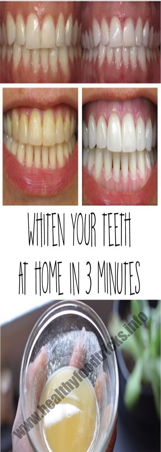 HOW TO DIY NATURAL TEETH WHITENING IN MINUTES AT HOME! HEALTH DIY BLOG