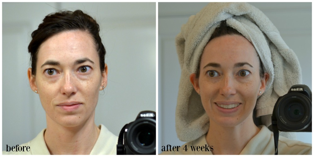 Effects Of Drinking Enouvh Water On Face Effects Of Drinking Enouvh Water On Face