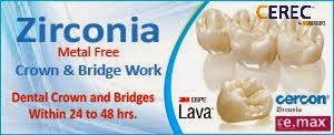 Zirconia Crown Delhi India