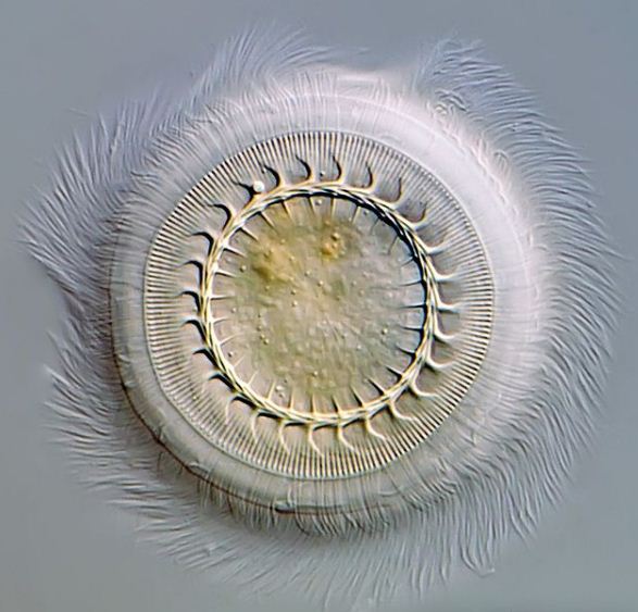 Jenis - Jenis Protozoa
