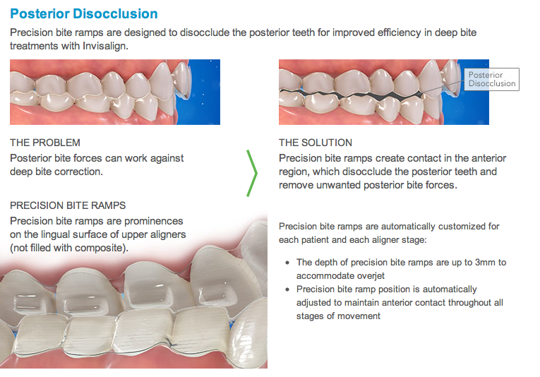 Your Markham Orthodontist, Toronto Invisalign, and Richmond Hill Braces