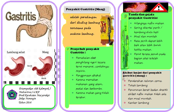 Recetas para gastritis
