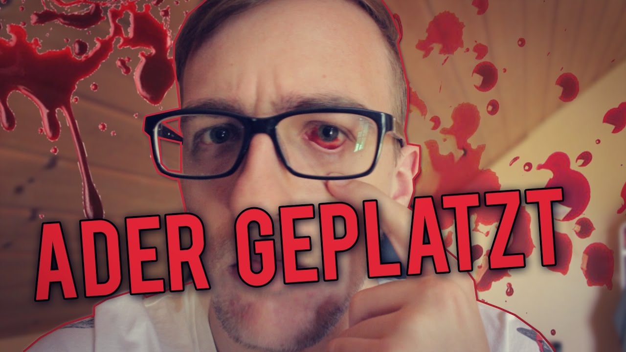 derchen im auge geplatzt - woodenbild :)