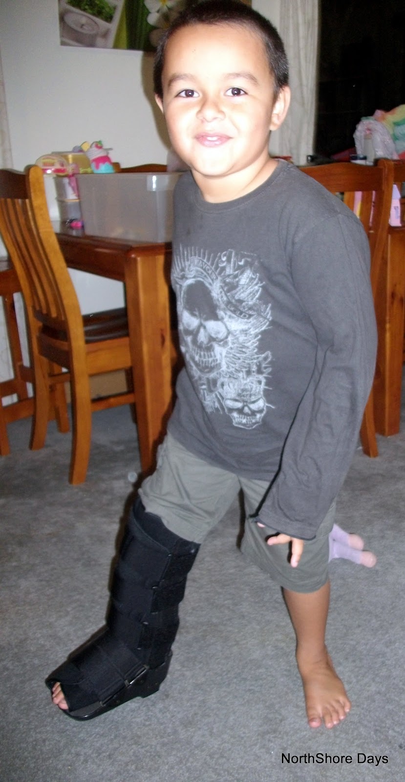 Moon Boot For Fractures Fracture Treatment