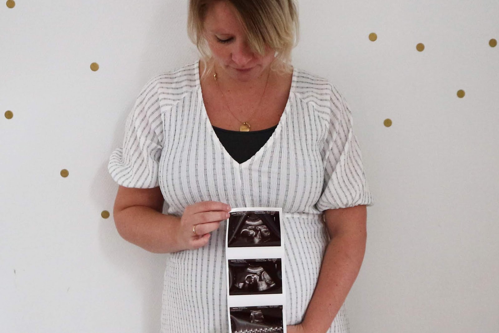 BABY BUMP || TWEEDE TRIMESTER