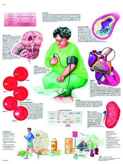 Medicamentos contra la hipertensión arterial