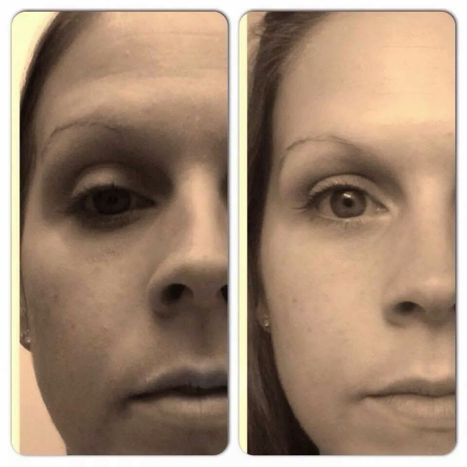 Nerium before and after 3