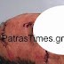 Απίστευτο! Γιατρός χαράκωσε στο πρόσωπο με μπουκάλι ασθενή στην Πάτρα