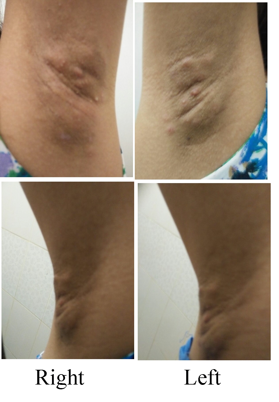 WARNING OF USING BAKING SODA IN ARMPITS AND YOUR TEETH IF YOU DON'T