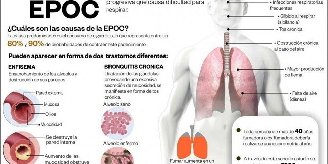 Día de la Prevención de la EPOC. [Infografía]