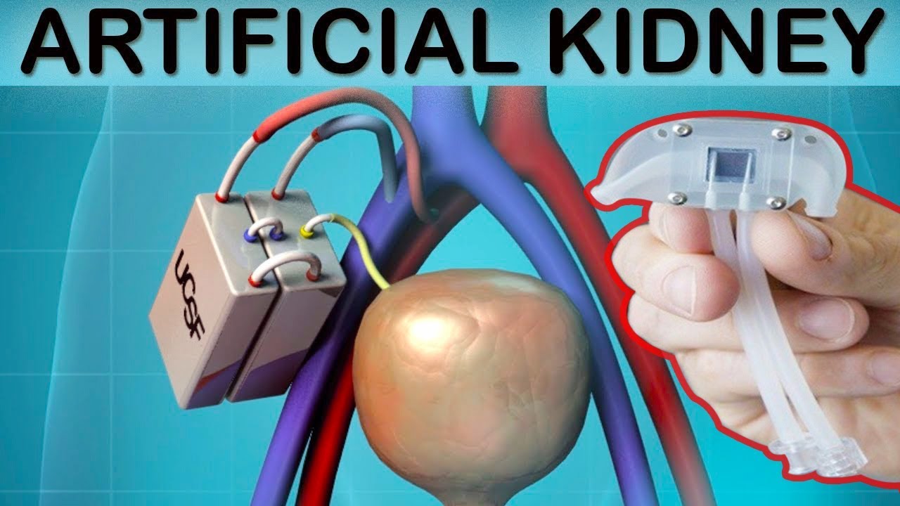Goodbye To Dialysis Machine Scientists Have Created A Bionic Kidney!