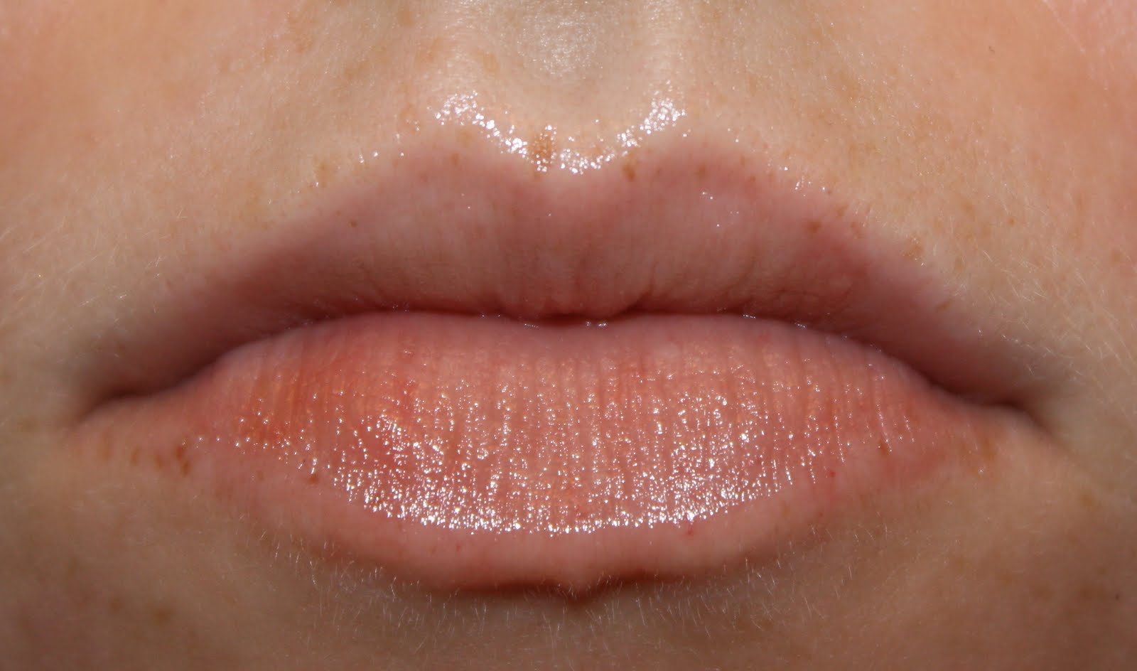 Allergic Reaction On Lips Eczema On The Lips Types Triggers Causes