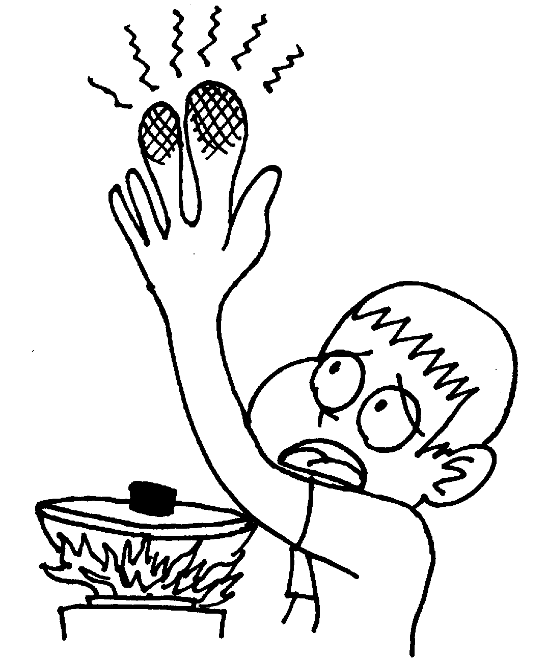 burned-hand.gif