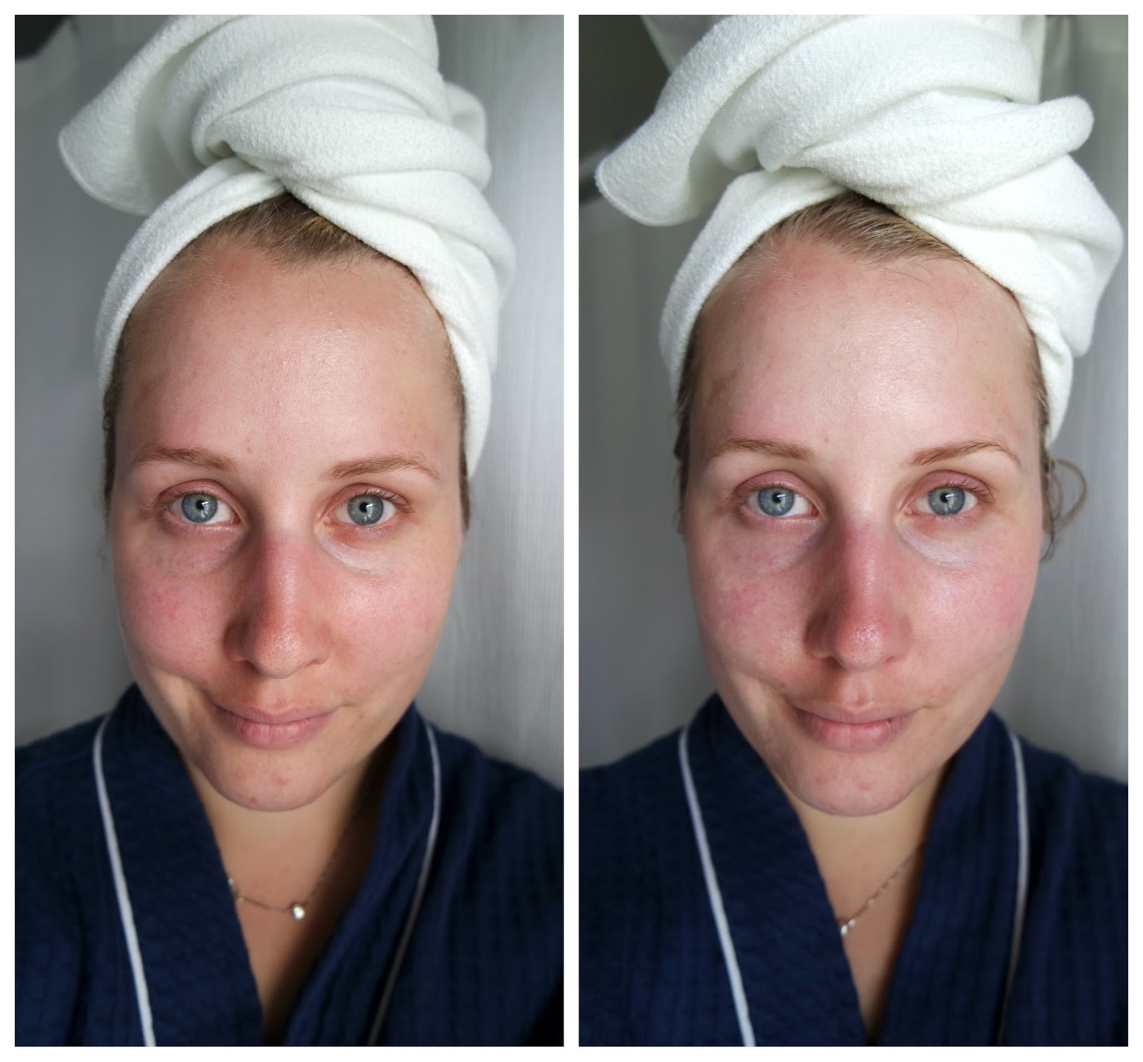 ole henriksen peel review