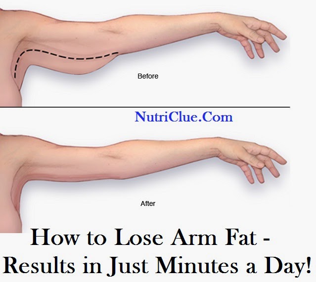 Loose Arm Fat Fast 117