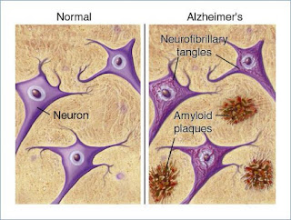 https://2.bp.blogspot.com/-c-kDk-E3iTs/V7rRxvLuxmI/AAAAAAAAo2w/95bTj3RL5X8-vSbJ8MNspwTtvmnmsJYmwCLcB/s640/neuron.jpg