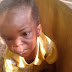 3 YEAR OLD CHILD BRUTALIZED BY HER OWN PARENTS BECAUSE THEY THINK SHE'S A WITCH (PHOTOS)