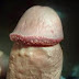 Obat Kutil Kelamin Dari Dalam thumbnail