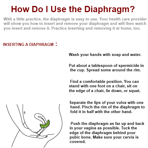 Diaphragm Birth Control Diaphragm Birth Control