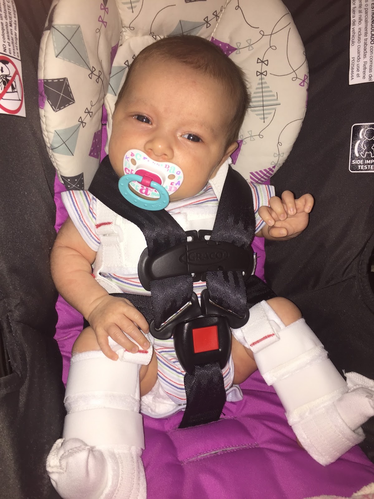 Lily's E'Claires Camille's Hip Dysplasia Life with a Pavlik Harness
