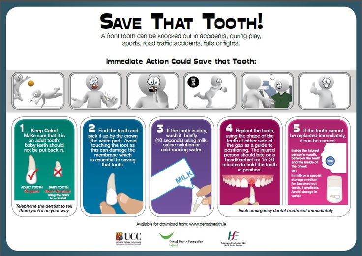 KIDS AND TEETH... Knocked out tooth...IT'S AN EMERGENCY!