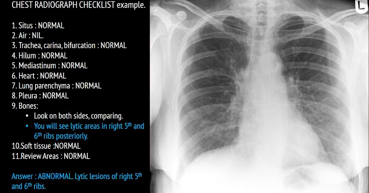 Ultimate Radiology Chest radiograph checklist for FRCR 2B Rapid Reporting