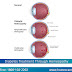 How Diabetes Effects on Eyes?