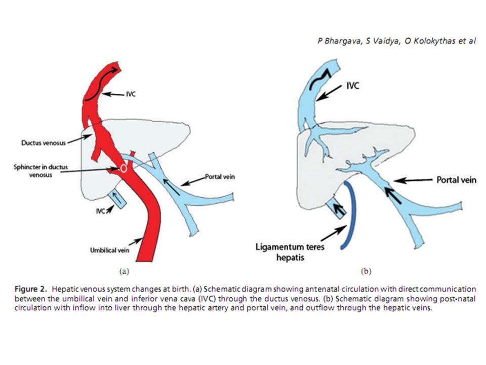 Portal Venous Shunt