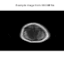 Visualizing An Image From DICOM File