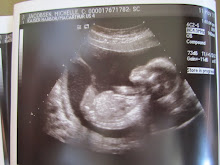 Berkley's 18 Week Ultrasound