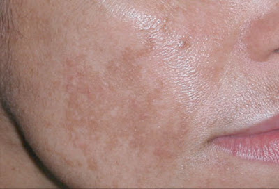 See the source image