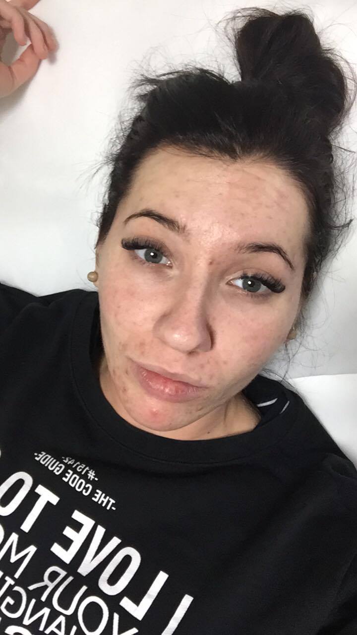 Płyn Jessnera - Moja nowa twarz