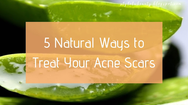 5 Natural Ways to Treat Your Acne Scars