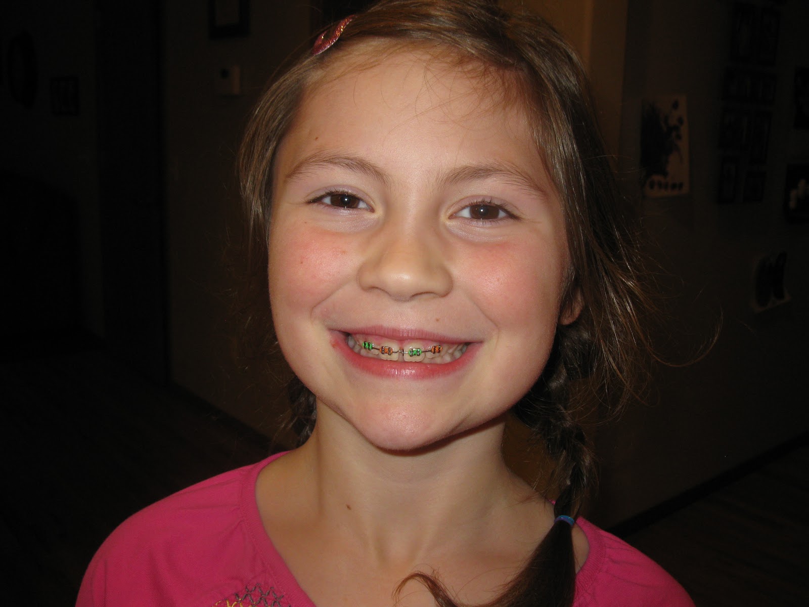 Avery and Annalise BRACES!!!!!