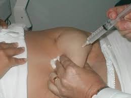 inyecciones de vitamina b12 para adelgazar