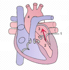 Mitral insufisiensi regurgitasi regurgitation insufficiency heart disease penyakit jantung