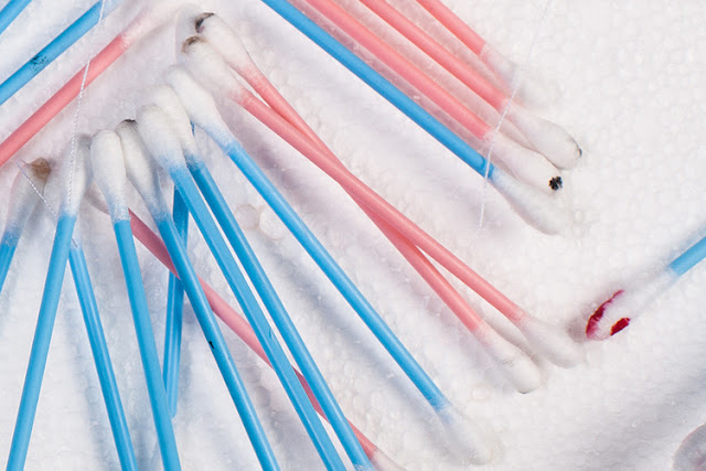 Jangan Pernah Gunakan Cotton Bud Lagi! Ini Dia Resikonya Jangan Pernah Gunakan Cotton Bud Lagi! Ini Dia Resikonya