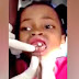 Ella Sentía Que ‘Algo’ Se Movía En Sus Encías, Va Al Dentista Y Extraen Esto