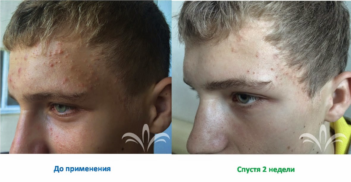 спустя. прошло несколько дней. применять спустя. применять спустя. минуту спустя.