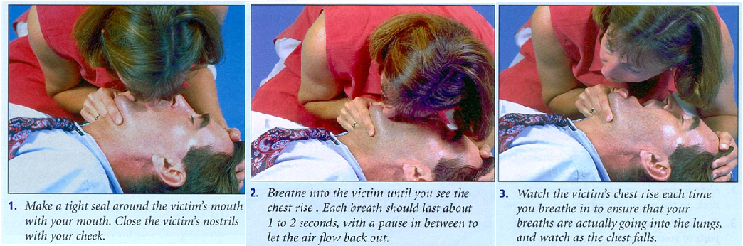 EAR (nafas buatan) diberikan kepada penderita yang tidak bernafas saja ...