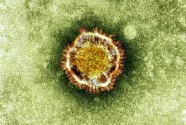 pengertian virus mers, gejala, penyebab dan pencegahan
