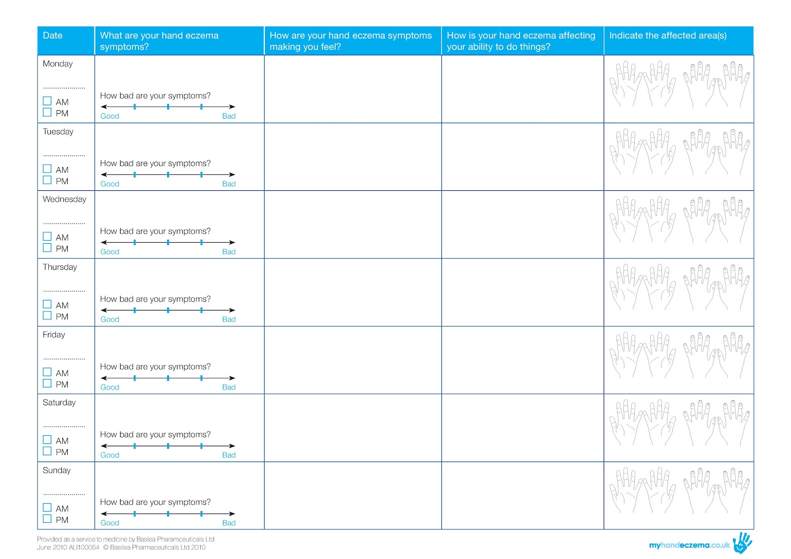 VIDEO BLOG The Allergy Shop sss Hand Eczema Diary
